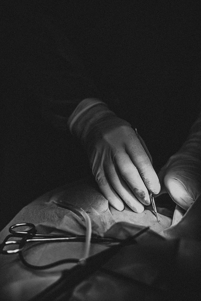 black and white close up photo of surgeons hands